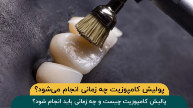پولیش کامپوزیت چه زمانی انجام میشود؟